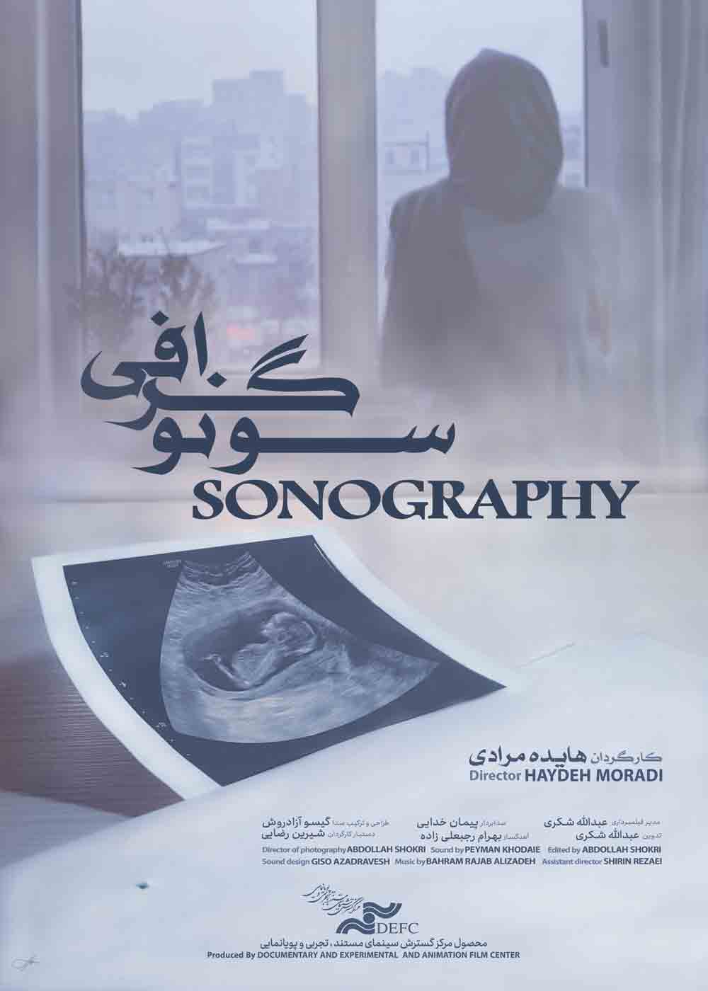 سونوگرافی
